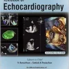 Textbook of Echocardiography, 2nd Edition (Original PDF from Publisher)