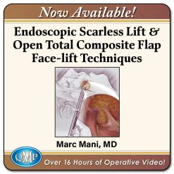 QMP Scarless Endoscopic & Open Composite Plane Face-lifting Techniques 2025
