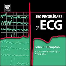 150 problèmes d'ECG (Original PDF from Publisher)