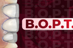 OHI-S B.O.P.T. Integrating Traditional and Digital Approaches