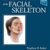 Aesthetic Surgery of the Facial Skeleton