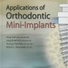 Applications of Orthodontic Mini-Implants