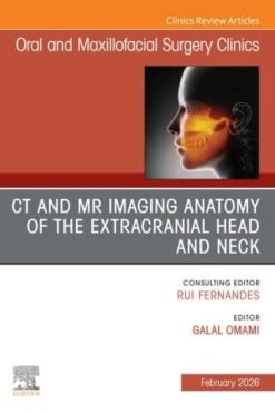 CT and MR Imaging Anatomy of the Extracranial Head and Neck, An Issue of Oral and Maxillofacial Surgery Clinics of North America (Original PDF from Publisher)
