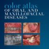 Color Atlas of Oral and Maxillofacial Diseases