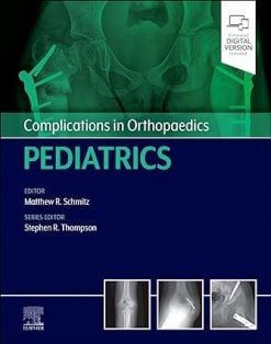 Complications in Orthopaedics: Pediatrics (Original PDF from Publisher)