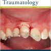 Dental Traumatology: Full Journal Archive (2010 – 2025)