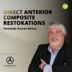 Direct Anterior Composite Restorations