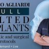 Full Tilted Implants: Prosthetic and Surgical Protocols