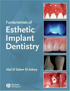 Fundamentals of Esthetic Implant Dentistry