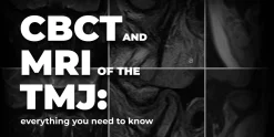 HI-S CBCT and MRI of the TMJ everything you need to know