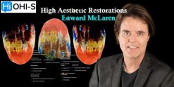 High Aesthetic Restorations (the Complete Course)