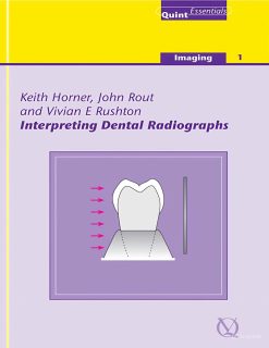 Interpreting Dental Radiographs