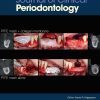 Journal of Clinical Periodontology, Full Archive (2005-2025)