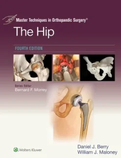 Master Techniques in Orthopaedic Surgery The Hip, 4th Edition (EPUB)
