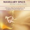 Maxillary Sinus Bone Grafting: A Picture Atlas Featuring over 50 Complete Step-By-Step Cases