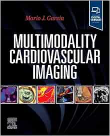 Multimodality Cardiovascular Imaging (Original PDF from Publisher)