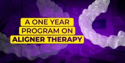 OHI-S A one year program on aligner therapy