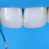 OHI-S Aesthetic Dentistry Congress in Milan Difficult cases in esthetic dentistry