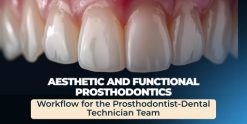 OHI-S Aesthetic and Functional Prosthodontics. Workflow for the Prosthodontist-Dental Technician Team
