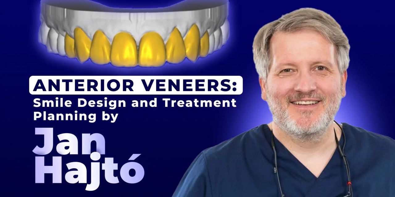 OHI-S Anterior Veneers Smile Design and Treatment Planning by Jan Hajtó