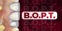 OHI-S B.O.P.T. Integrating Traditional and Digital Approaches