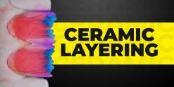 OHI-S Ceramic layering protocols of the world’s leading schools