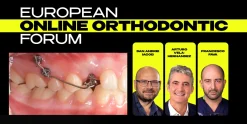 OHI-S European Online Orthodontic Forum. Advanced Protocols and Innovative Orthodontic Practices Include: 6 videos + 6 audios + 6 file sub vtt, size: 3.16 GB Target Audience: orthodontists, general dentists Information: 6 lessons (5h 28min) Advanced protocols and innovative practices in orthodontics are featured in the online version of the European Orthodontic Forum, where high treatment standards meet high expertise! During the course, you will explore the most relevant topics in modern orthodontics: – Biomechanics of orthodontic treatment – Aligner therapy for open bite – Aligners + skeletal anchorage – Orthodontic treatment of patients with TMD – Use of cantilevers for the treatment of canine impaction. You will enjoy lectures from outstanding specialists who share only clinical, experience-based content — practical insights, real cases, and evidence-based approaches that can be directly applied in your daily orthodontic practice. The OHI‑S European Online Orthodontic Forum: Advanced Protocols and Innovative Orthodontic Practices is best for orthodontists, dentists, and allied professionals who want CE‑accredited training in cutting‑edge orthodontic techniques, interdisciplinary workflows, and evidence‑based protocols. It is designed as a high‑level forum to share innovations and advanced practices across Europe and internationally. 👩‍⚕️ Who Should Attend Orthodontists seeking to update their knowledge with advanced protocols and innovative treatment strategies. General dentists who integrate orthodontics into comprehensive care plans. Prosthodontists & restorative dentists collaborating on interdisciplinary cases involving orthodontic alignment. Oral & maxillofacial surgeons coordinating surgical orthodontic cases with functional and aesthetic outcomes. Dental technicians supporting orthodontic workflows with digital and lab‑based innovations. Residents, fellows, and trainees in orthodontics or restorative dentistry gaining exposure to international best practices. 📚 What You’ll Learn Advanced orthodontic protocols: modern biomechanics, aligner therapy, and interdisciplinary case management. Innovative practices: digital workflows, AI‑assisted planning, and minimally invasive orthodontics. Functional integration: occlusion, airway, and musculoskeletal considerations in orthodontic treatment. Aesthetic optimization: smile design and facial harmony in orthodontic planning. Case‑based lessons: real patient examples demonstrating predictable outcomes. International perspectives: insights from European experts on evolving orthodontic standards. Topics: Lesson 1.Principles and Biomechanics of Open Bite Treatment with Aligners – Advantages of treating open bites with aligners as opposed to conventional fixed appliances – Misconceptions in the planning of open bite treatment with aligners – Basic biomechanical resources – The different planning strategies based on scientific evidence – Evidence-based biomechanical concepts – Typical errors in open bite diagnosis and treatment planning. Recommended for: Orthodontists, General dentists. Lesson 2.Advanced Planning and Treatment Protocols for Open Bite with Aligners and TADs – Evidence-driven approaches to open bite correction – Sequencing of tooth movements for optimal results – How to handle auxiliary resources in severe cases – Treatment protocols for complex cases with aligners and skeletal anchorage devices – Analysis of clinical cases. Recommended for: Orthodontists, General dentists. Lesson 3.Orthodontic Treatment of Patients with TMD – Principles of orthodontic treatment for patients with TMJ dysfunctions – Analysis of the TMJ and biomechanical movement of the lower jaw – Introduction to splint therapy in the orthodontic context – Biomechanics of orthodontic treatment for patients with TMJ dysfunctions. Recommended for: Orthodontists, General dentists. Lesson 4.Splint Therapy and Clinical Applications for Orthodontic Patients – When and why splint therapy is indicated – Integration with orthodontic treatment – Types of splints: – Occlusal splints: stabilization, repositioning, and functional – Selection criteria based on patient presentation. – Clinical application: – Combining splint therapy with orthodontic biomechanics – Monitoring patient progress and adjusting treatment. Recommended for: Orthodontists, General dentists. Lesson 5.Cantilevers: Key to Success in Canine Impaction Management – Overview of impacted canines and their clinical challenges – The clinical advantages and the potential of cantilevers – Why are cantilevers for impacted canines more efficient and effective than elastic tractions. Recommended for: Orthodontists, General dentists. Lesson 6.Clinical Protocols and Case Applications of Cantilevers – When to use cantilevers in clinical practice – Basic principles of cantilever mechanics – Step-by-step bending techniques for clinical use – Avoiding common biomechanical errors – Analysis of clinical cases. Recommended for: Orthodontists, General dentists.