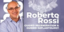 OHI-S Guided regeneration & Guided Implantology