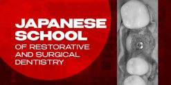 OHI-S Japanese School of Restorative and Surgical Dentistry