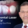 OHI-S Laser Periodontology Optimizing the Pink Aesthetic