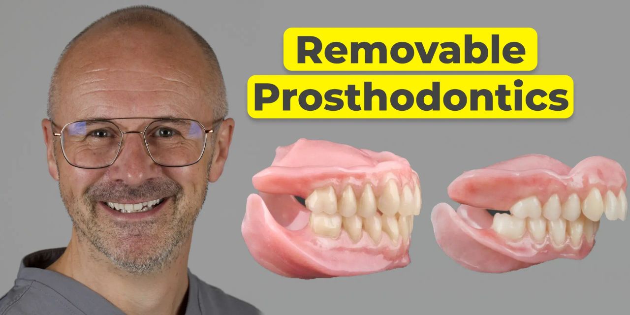 OHI-S Removable Prosthodontics Enhancing Function and Aesthetics
