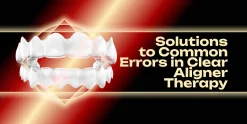 OHI-S Solutions to Common Errors in Clear Aligner Therapy