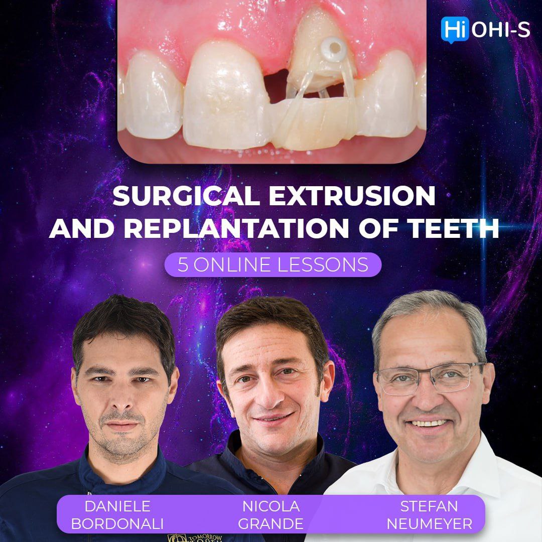 Surgical Extrusion and Replantation of Teeth
