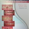 Toothwear: The ABC of the Worn Dentition