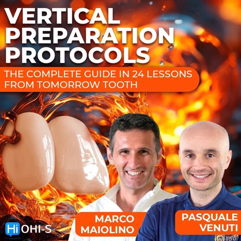 Vertical Preparation Protocols The Complete Guide in 24 Lessons from Tomorrow Tooth