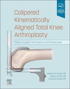 Calipered Kinematically aligned Total Knee Arthroplasty: Theory, Surgical Techniques and Perspectives (Videos Only)