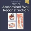 Atlas of Abdominal Wall Reconstruction, 3rd Edition (EPUB)
