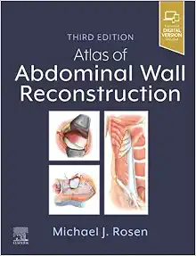 Atlas of Abdominal Wall Reconstruction, 3rd Edition (EPUB)