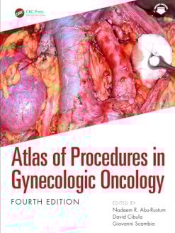 Atlas of Procedures in Gynecologic Oncology, 4th edition (Original PDF from Publisher)
