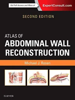 Atlas of Abdominal Wall Reconstruction, 2nd Edition (Videos, Organized)