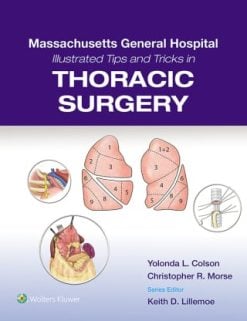 MGH Illustrated Tips and Tricks in Thoracic Surgery (EPUB)