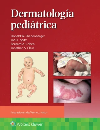 Dermatología pediátrica (EPUB)