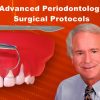 Advanced Periodontology Surgical Protocols