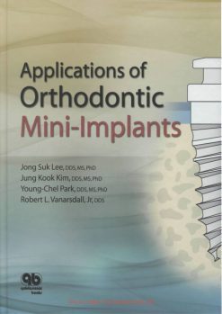 Applications of Orthodontic Mini-Implants