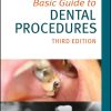 Basic Guide to Dental Procedures (Basic Guide Dentistry Series)