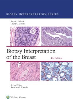 Biopsy Interpretation of the Breast (Biopsy Interpretation Series), 4th Edition (EPUB)