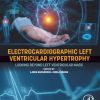 Electrocardiographic Left Ventricular Hypertrophy