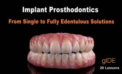 Implant Prosthodontics – From Single to Fully Edentulous Solutions