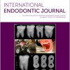 International Endodontic Journal, Full Archive (2008 – 2025)