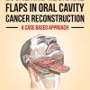 Local and Regional Flaps in Oral Cavity Cancer Reconstruction: A case-based approach